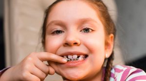 Braces Treatment Issaquah