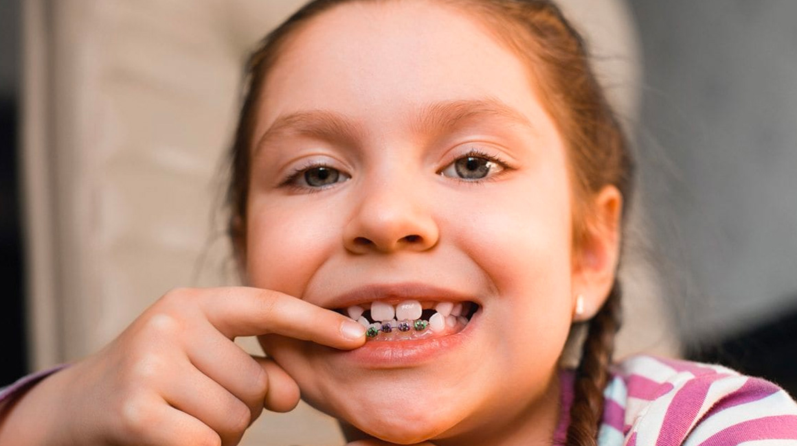 Orthodontics treatment for child Issaquah
