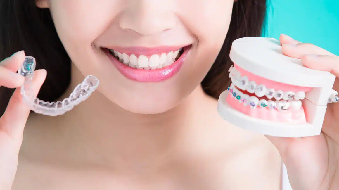 Invisalign aligners in Issaquah