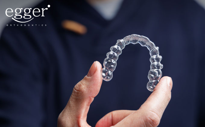 Orthodontic appliances, such as a clear aligner