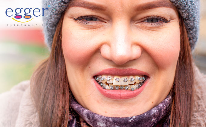 Common orthodontic problems and malocclusions are why people might need braces.