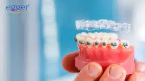 Braces Vs. Aligners? The answer usually comes down to personal preference as they're both equally effective.