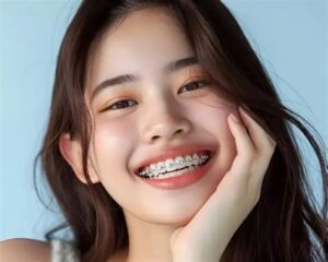 How to Recognize Signs You Need Braces